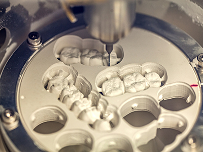 Linda Ricks DDS., MS, PC | E4D, ZOOM  Whitening and Dentures