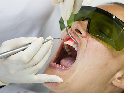 Linda Ricks DDS., MS, PC | VELscope reg  Cancer Screening, Veneers and Periodontal Treatment