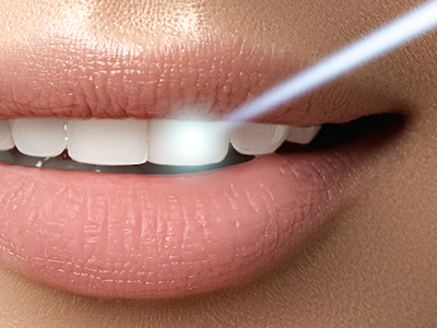 Linda Ricks DDS., MS, PC | Dental Cleanings, Preventative Program and Dentures
